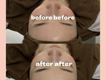 リタ 銀座(Rita)/ 水素パックシェービング☆1回