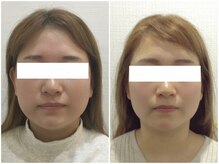 美容整体 ウェリナ 蟹江院/小顔矯正/骨盤矯正/美脚サロン 