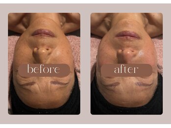 ステラ(STELLA)/マイナス◯歳も可能!?