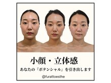 ふらっとエステ