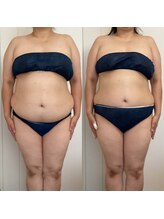 サンテ エ ボーテ 福岡博多店(Sante et Beaute)/痩身/結果重視サロン◎