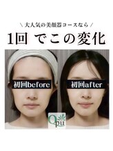 キュープ 群馬吉岡店(Qpu)/初回で効果実感◎小顔矯正
