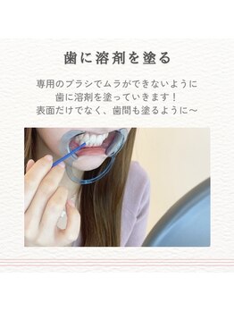 エクシアホワイトニング 津駅前店/06.歯に溶剤を塗る