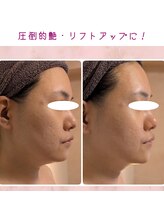 プライベートサロン 美月/