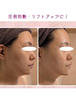 プライベートサロン 美月/