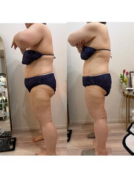 ヒメ ビューティー(Hime beauty)/2回