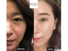 BBC 田園調布/スピダイヤ効果