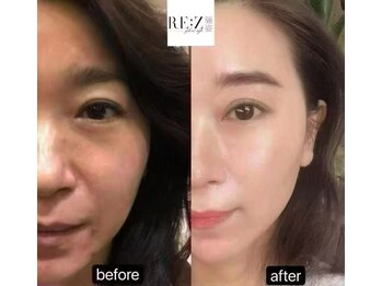 BBC 田園調布/スピダイヤ効果