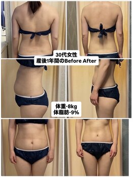 ヌーボ(NUeVo)/産後1年間のBeforeAfter