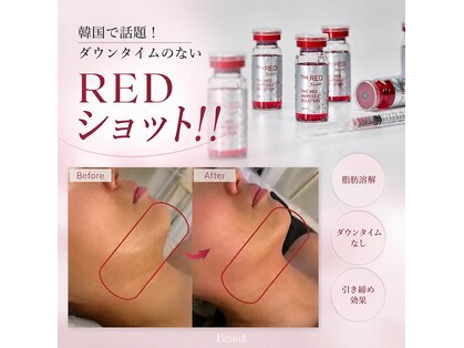 リュクシア(LUXIA)の写真