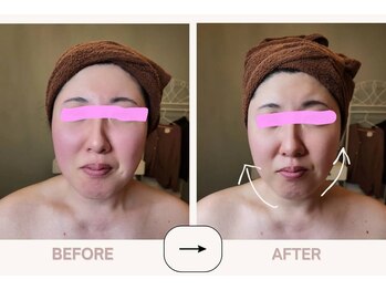 アンカシェット(en cachette)/小顔フェイシャル