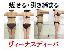 エリュクス(et Luxe)/ヴィーナスディーバで即スリム