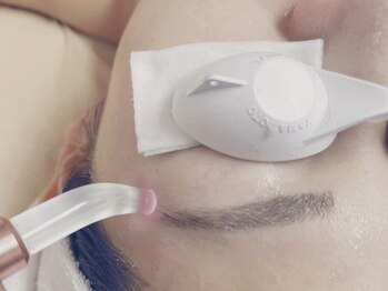 脱毛サロン エルベル(elleBelle)の写真/【全顔+首脱毛+(筋膜小顔ケア)1回¥6200】細かくどこよりも丁寧!/進化版ララピールのセラピール導入