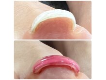 アンドネイル(+ and Nail)