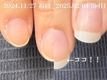 ティアリー(Tiary)/自爪育成(ケア)