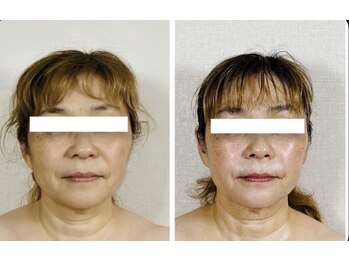 真美(Sinbi)/施術2回で!!