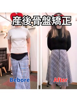 さらさ整骨院/産後骨盤矯正ビフォー・アフター