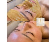 美創館フレッシュ(Fresh)の雰囲気（【爆発的人気】産毛、顔ダニ、角質ごっそり除去！松ヤニパック！）