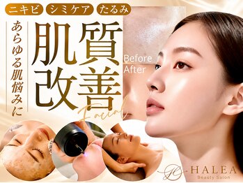 ハレア(HALEA)の写真/本場韓国大HIT中インモードリフトアップ施術を更に進化させたワンモードでフィラー要らずの造形美を実現◎