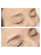 ホワイトアイ 姫路(WHITE EYE)/【アイブロウ】ビフォーアフター