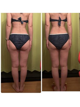 ヨサ パーク コアハート(YOSA PARK CORE HEART)/