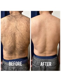 シェービーズ(shavys)/上半身（顔無）