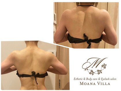 リラクゼーション モアナヴィラ(MOANA VILLA)の写真