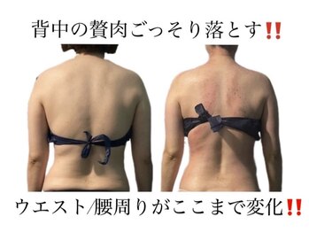 痩身革命 大宮店/ダイエットリンパマッサージ