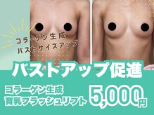 モビー 天王寺店(mobee)の雰囲気(30代人気/育乳/バストアップケア/バストケアトリートメント)