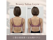 レイラ(Leyra)の雰囲気（お悩み・理想・お身体に合った施術の内容を選抜。熊本市バスト♪）