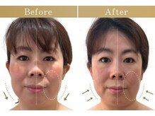 ドクターボディ 自由が丘店(Dr.Body)の雰囲気(【顔の大きさ/頬のたるみ/ほうれい線/輪郭のもたつき/目の開き】)
