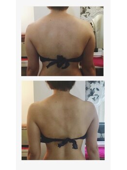 ボディインパクト プロデュース バイ アミカ(Body Impact produce by AMiCA)/◆痩身クリームでデトックス◆