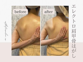 オートクチュール エステティックサロン シーズ/肩甲骨剥がし×ほぐし