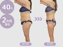 ビップ 赤坂店(Bipp!)/40代・2カ月の変化