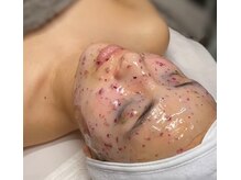 アンジェリカ(Angelica)/ハイドロジェリーマスク