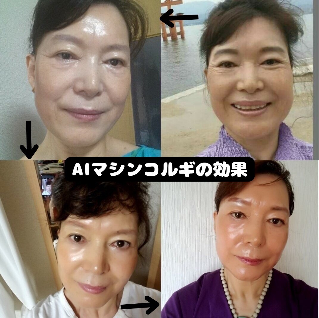 韓国エステサロン 憩｜ホットペッパービューティー