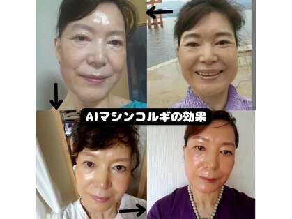 韓国エステサロン 憩の写真