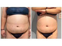 ルナグランデ 心斎橋店(Luna grande.)/サイズダウン