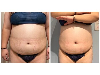 ルナグランデ 心斎橋店(Luna grande.)/サイズダウン