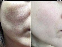 ビューティー ボディ スラ(Beauty body)の雰囲気（お肌の悩みを改善し、美しく透明感のあるお肌へ導きます。）