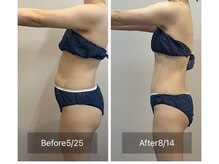 セレア(CELEA)/痩身/ダイエット/全身痩せ-8キロ