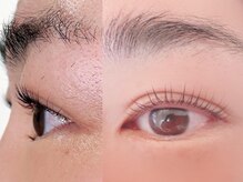 ノブレス 赤坂店(Noblesse)/オルチャンドリームロット