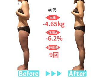 ビースタイル 多治見店(B'style)/40代マイナス4.5キロ