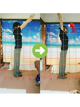 サプライズ整体院/30代ママさんの肩こり初回結果