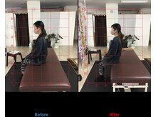 ストレチックス 近江八幡店/姿勢改善ビフォーアフター