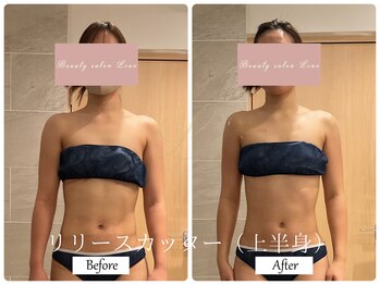 リノ(Lino)/ブライダルエステでご来店♪