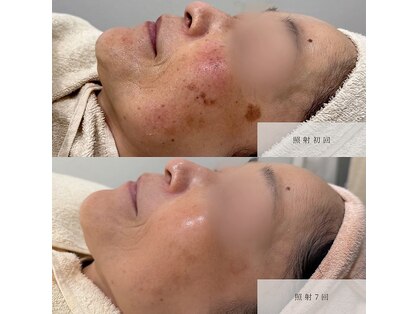 ルコア ドゥ(rucor doux)の写真