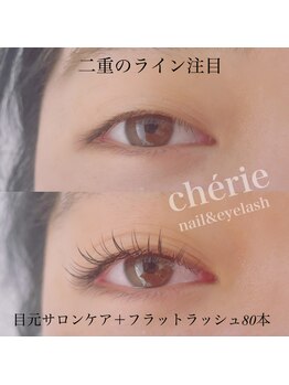 シェリー(cherie)/目元エステ＋マツエク80本