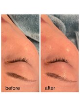 サロン ド ミモザ(Salon de Mimosa)/幹細胞フェイシャル