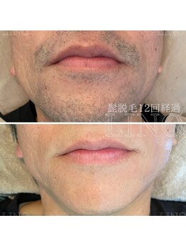 リノ(Lino)/メンズのメニューも豊富！